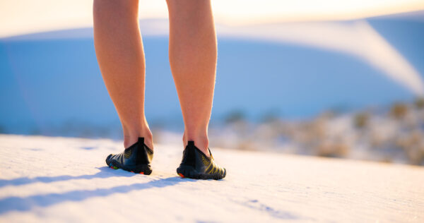 Stages of Varicose Veins