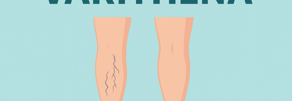 Varithena Procedure, Side Effects & Patient Reviews